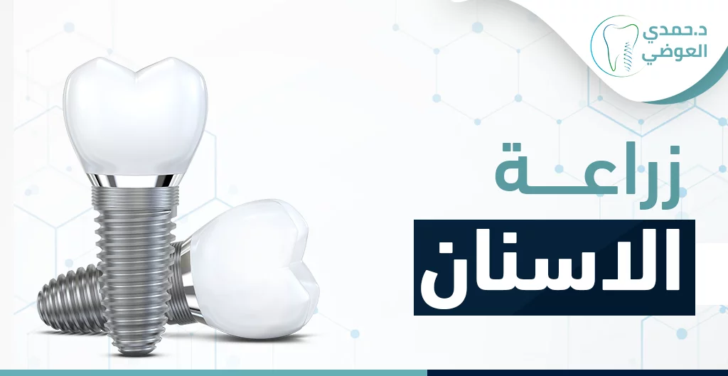 لماذا يُعد مركز ميراس خيارًا مثاليًا في زراعة الأسنان لكبار السن؟