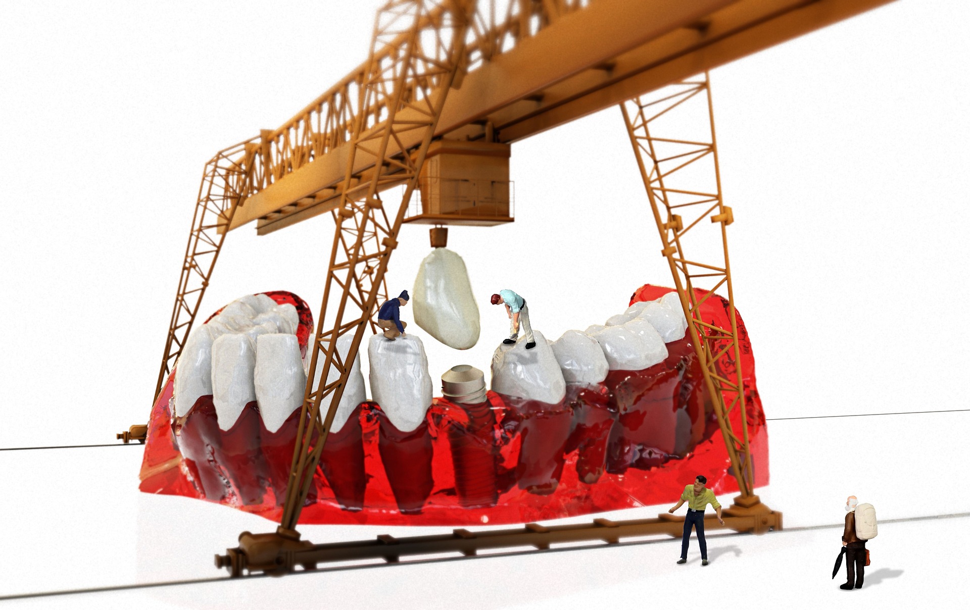 عملية زراعة الأسنان: رحلة استعادة الثقة من التشخيص إلى الابتسامة النهائية